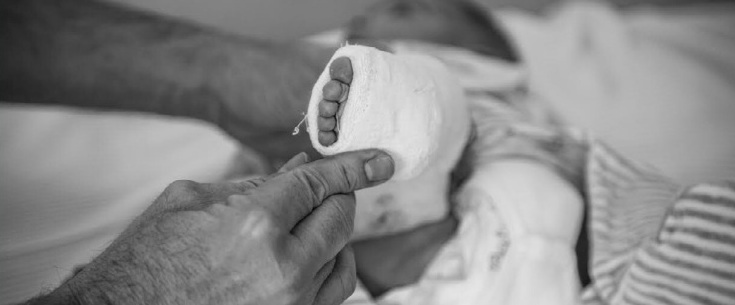 Immagine di gesso ortopedico (particolare)