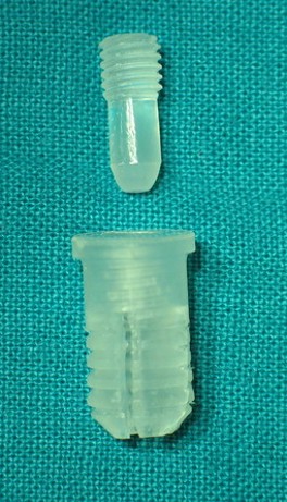 Endortesi riassorbibile