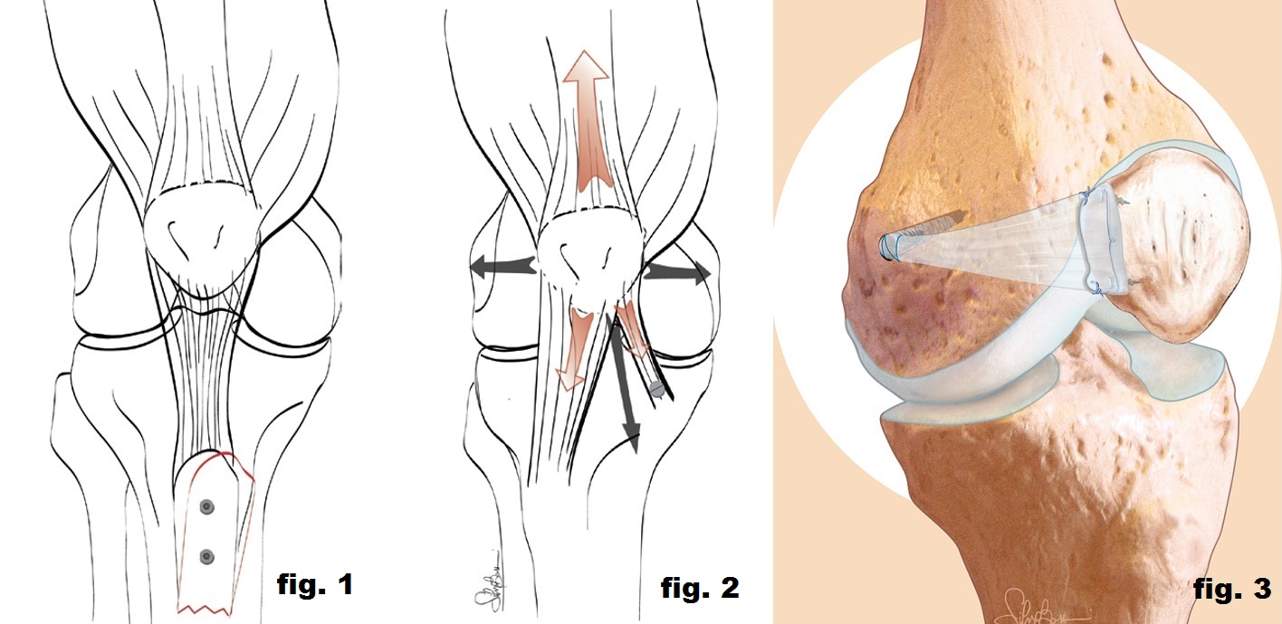 Figura 1, figura 2 e figura 3.