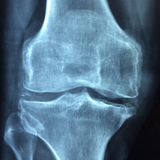 immagine radiografica